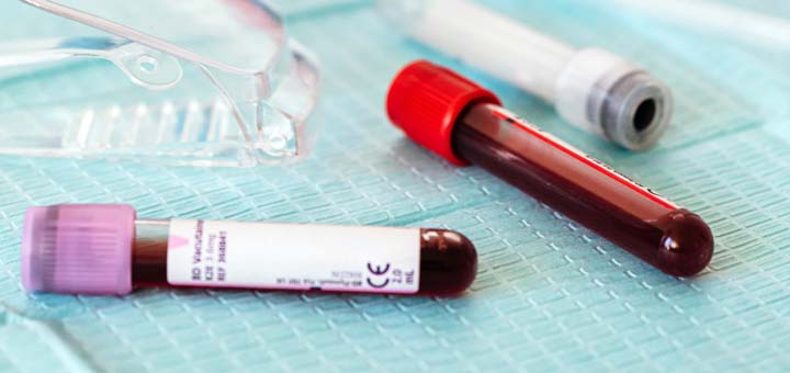 Blood tests